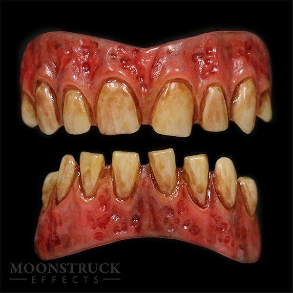 Moonstruck Urit Stained Teeth